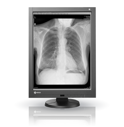 EIZO RadiForce GX340, product photo