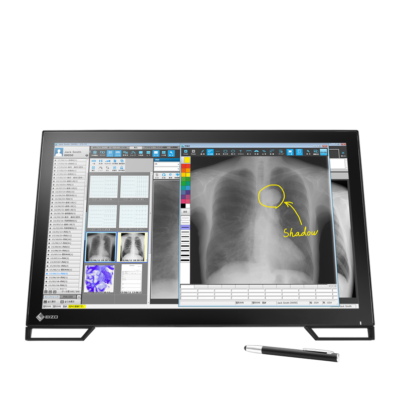 EIZO RadiForce MS236WT A, product photo