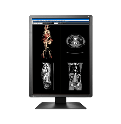 EIZO RadiForce MX216, product photo