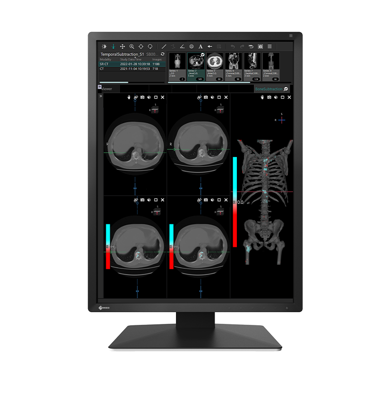 EIZO RadiForce MX217, product photo
