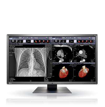 EIZO RadiForce MX315W, product photo
