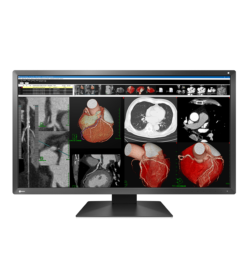 EIZO RadiForce MX317W, product photo