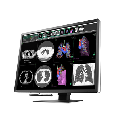 EIZO RadiForce RX1270, product photo