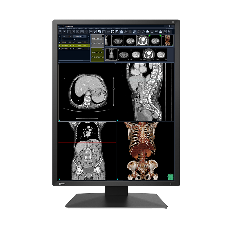 EIZO RadiForce RX270, product photo