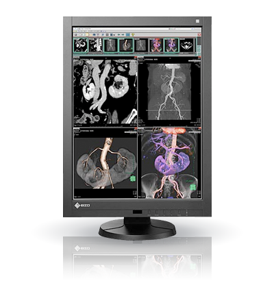 EIZO RadiForce RX340, product photo