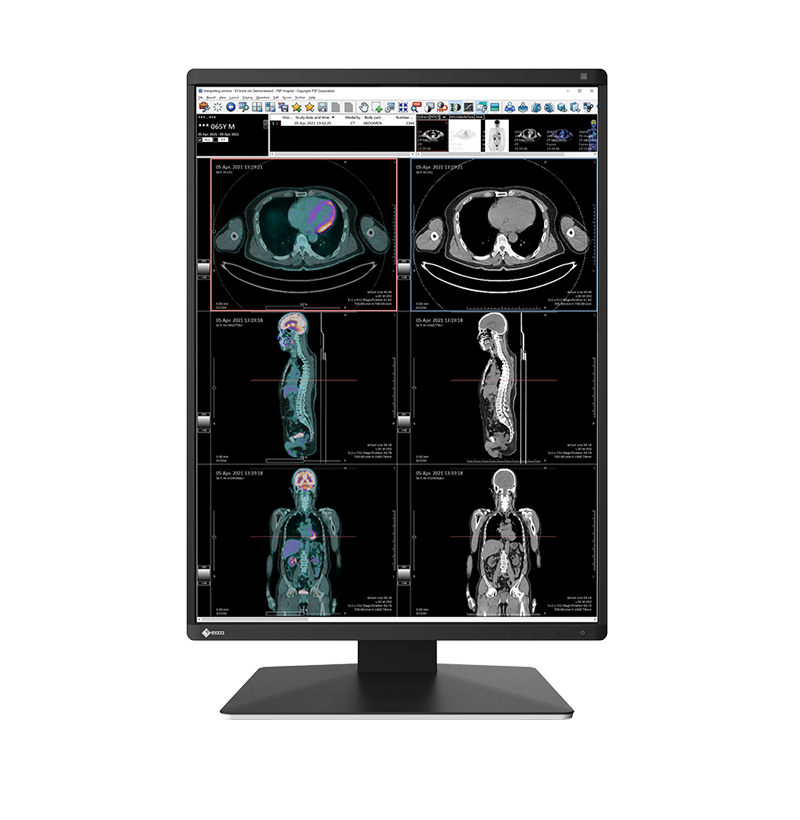 EIZO RadiForce RX370, product photo