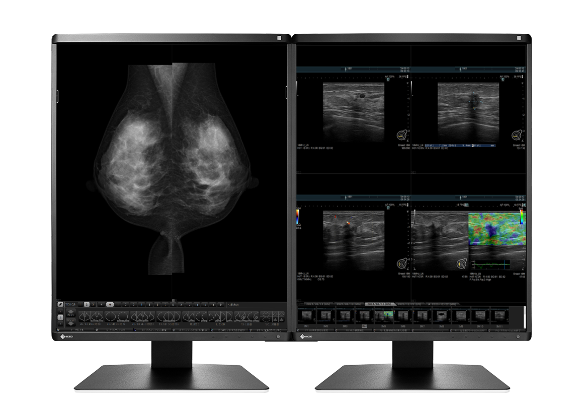 EIZO RadiForce RX570, product photo