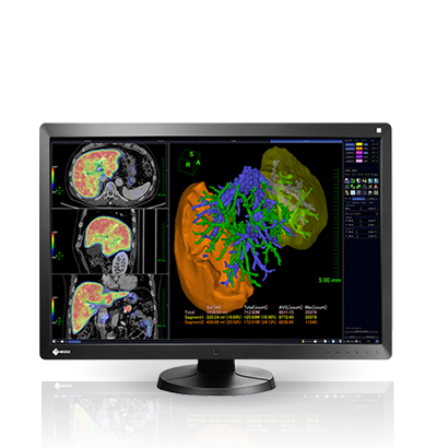 EIZO RadiForce RX650, product photo