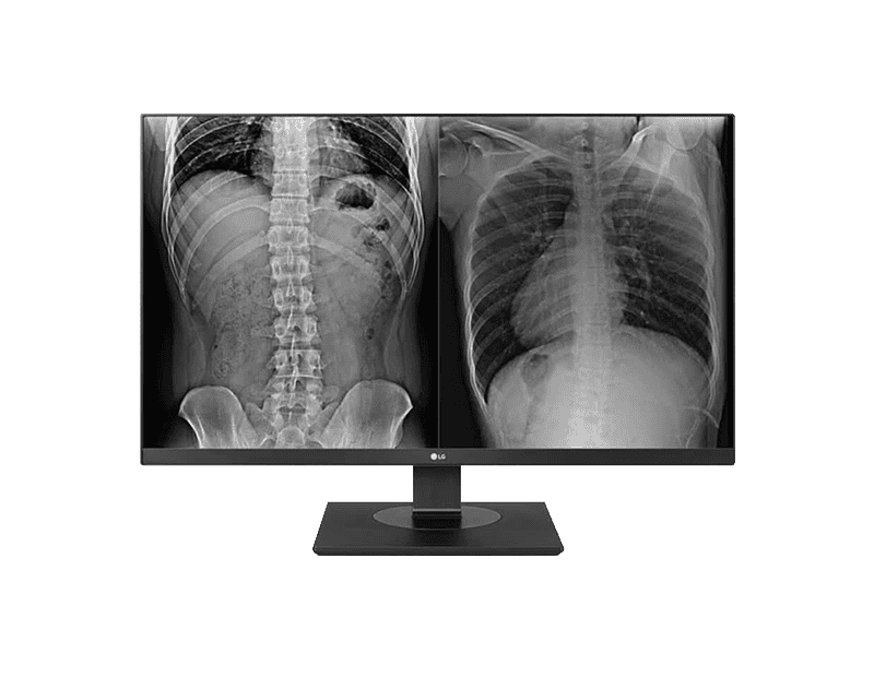 27” UHD IPS Clinical Review Monitor