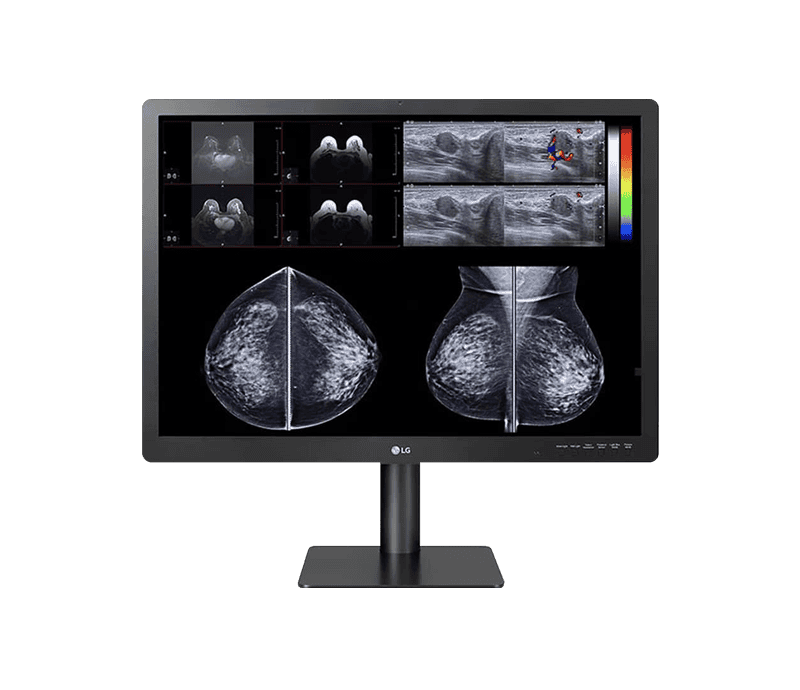 31” 12MP IPS Diagnostic Monitor for Mammography