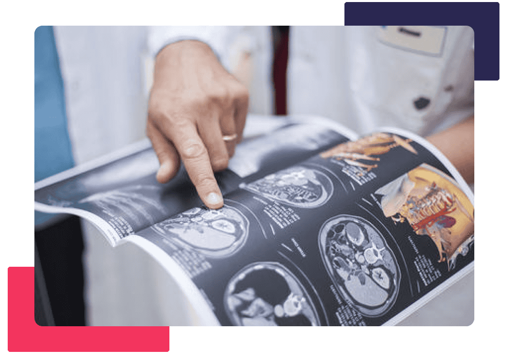 A man pointing to a medical imaging paper.