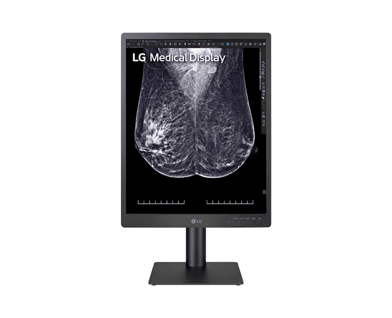 21.3″ 5MP IPS Diagnostic Monitor for Mammography | 21HQ613D