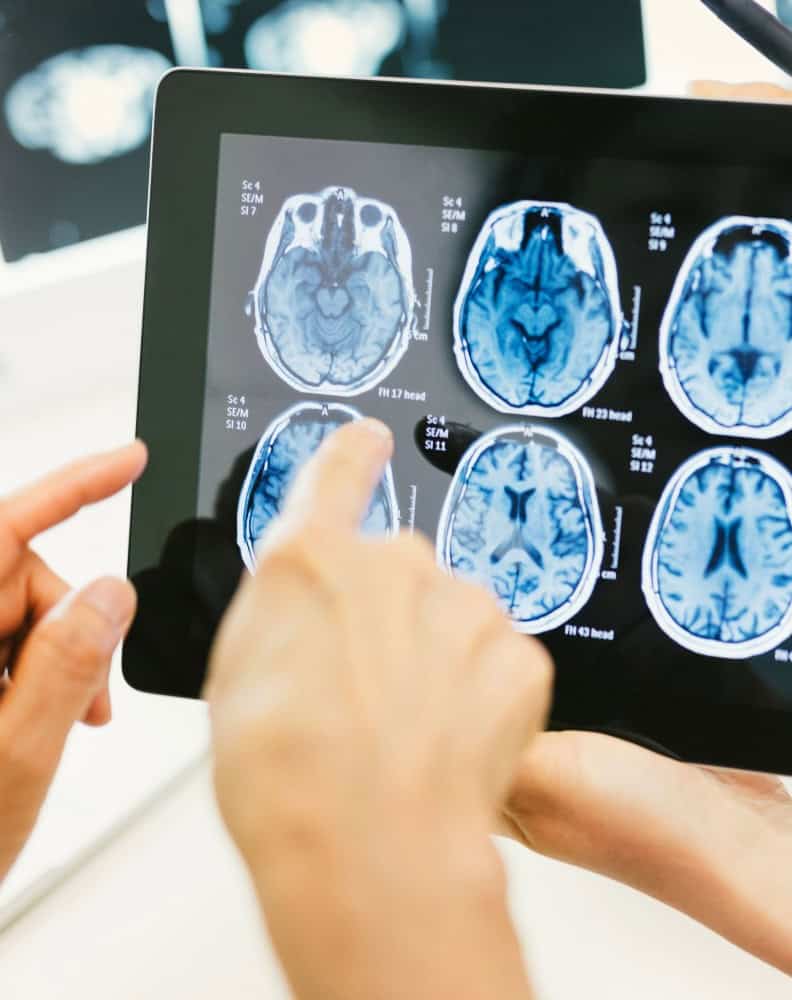 handheld tablet showing CT scan results and the other person is pointing at the result