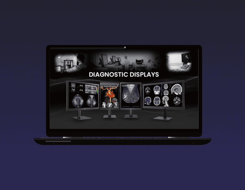 Opened Laptop showing Different types of LG Diagnostic Displays and images of radiologists checking the results of ct scans and xray in the background