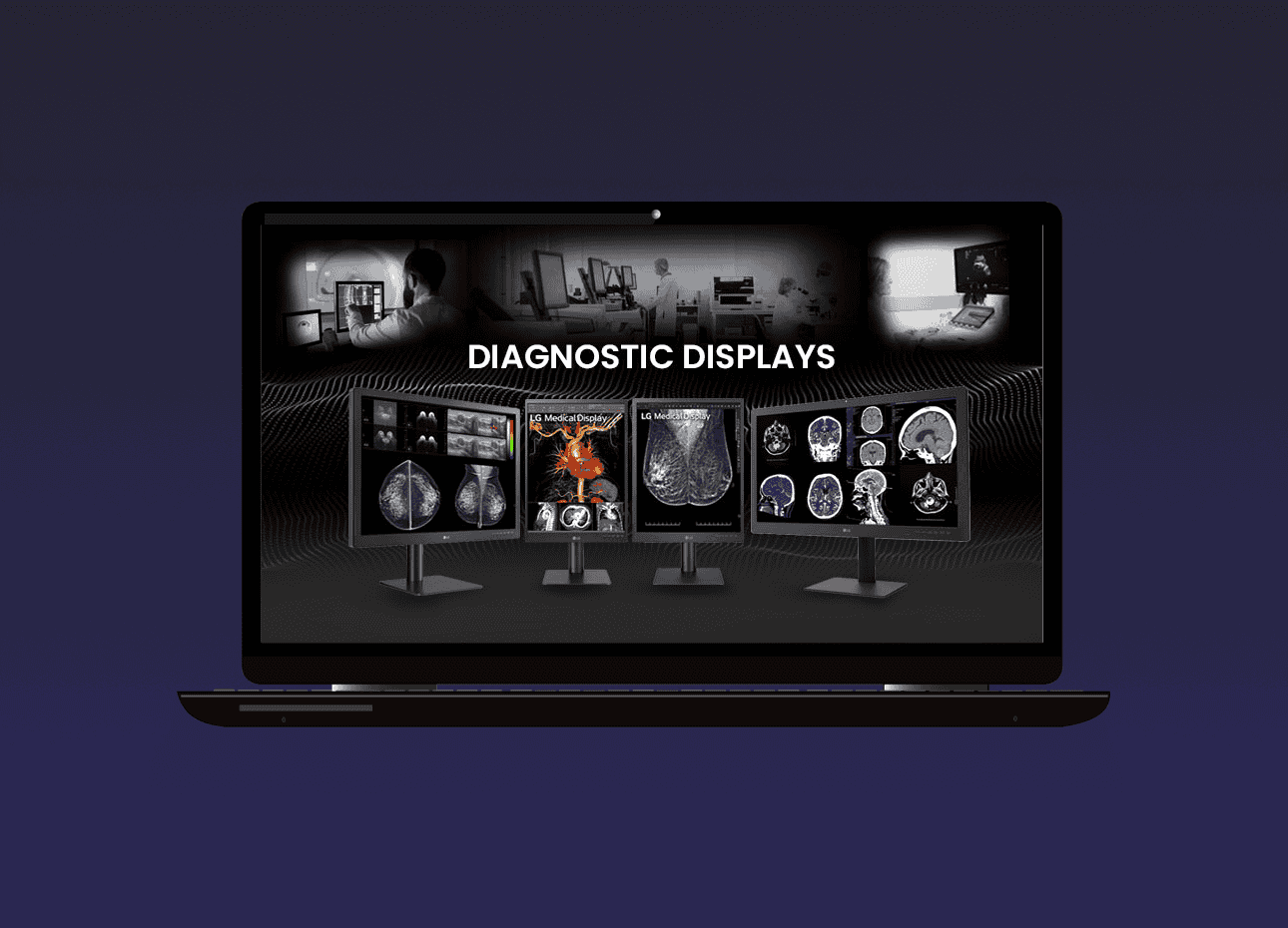 Opened Laptop showing Different types of LG Diagnostic Displays and images of radiologists checking the results of ct scans and xray in the background