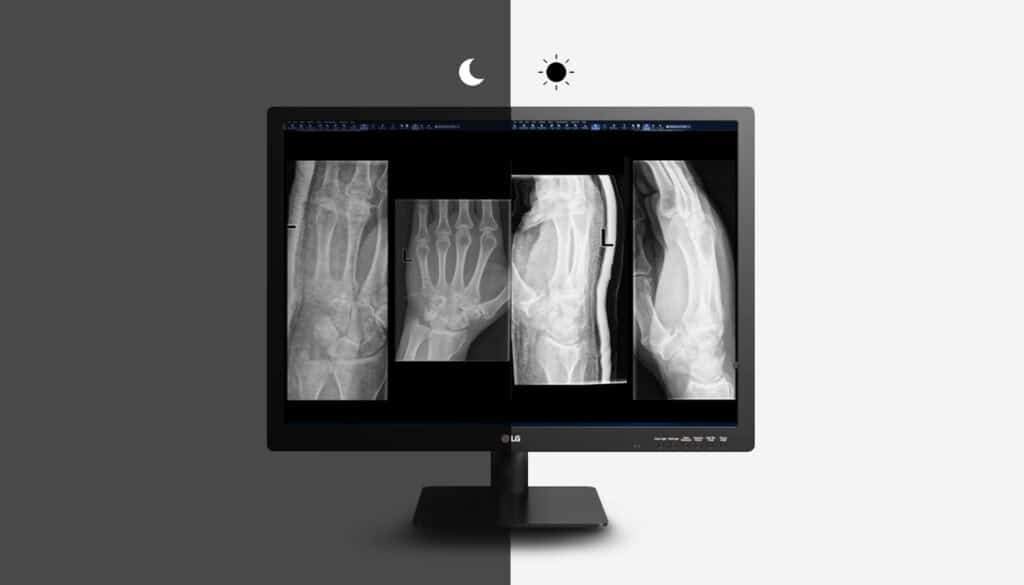 diagnostic display showing auto adjustment of luminance based on lighting of the room