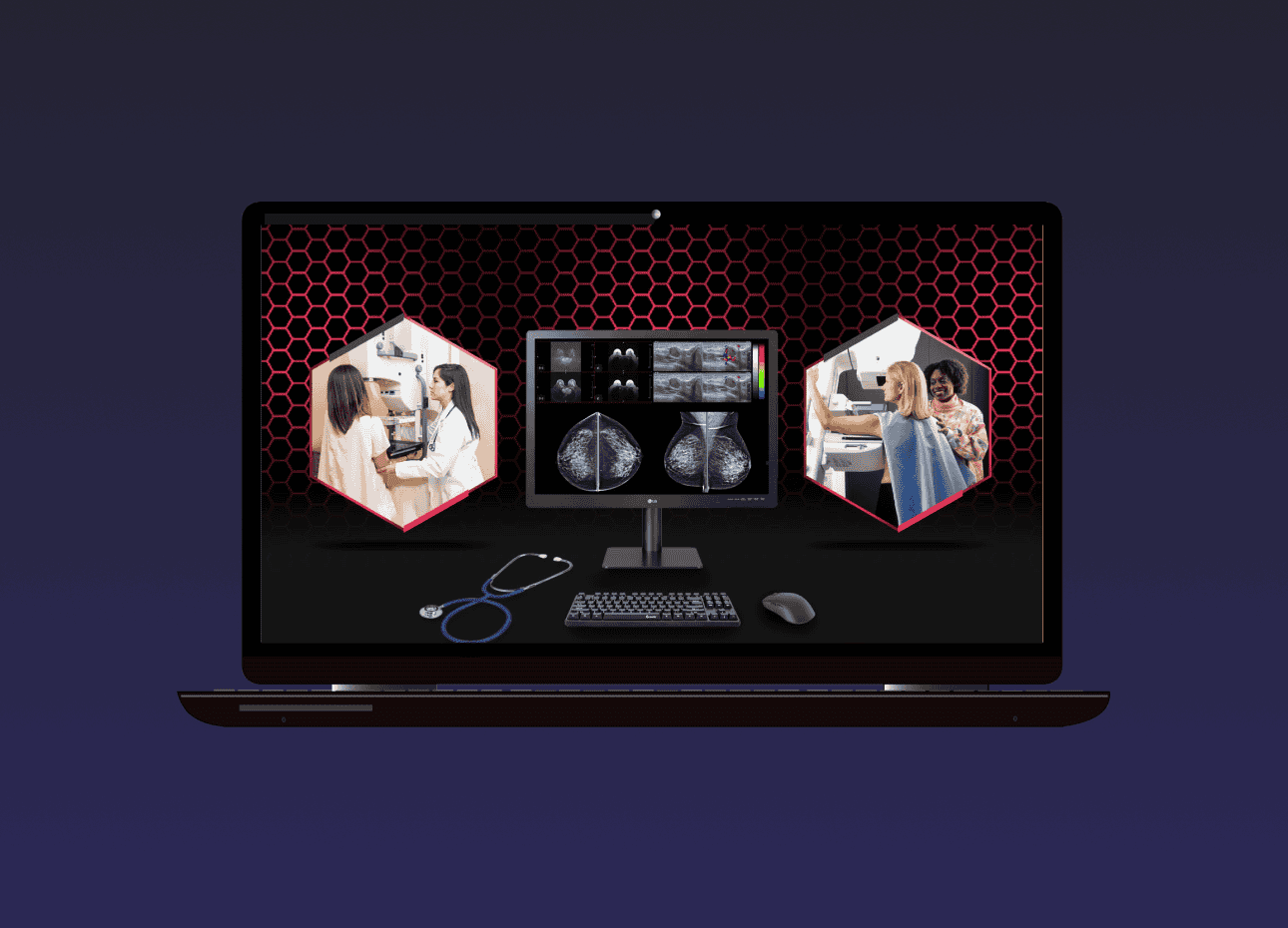 Opened laptop showing a Diagnostic Display that can be used for Mammogram and photos of nurse and patient on either side of the monitor