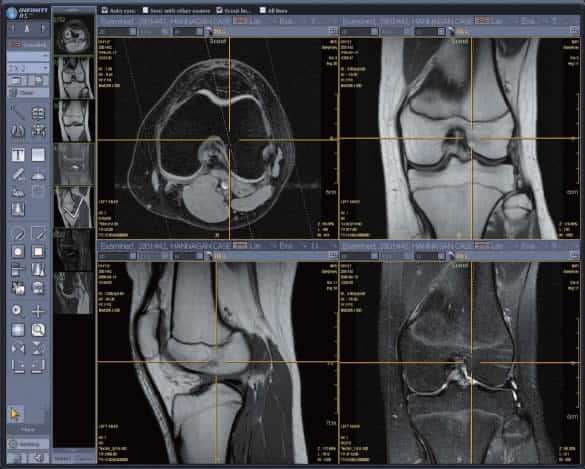 X-ray images shown in from infinit PACS application